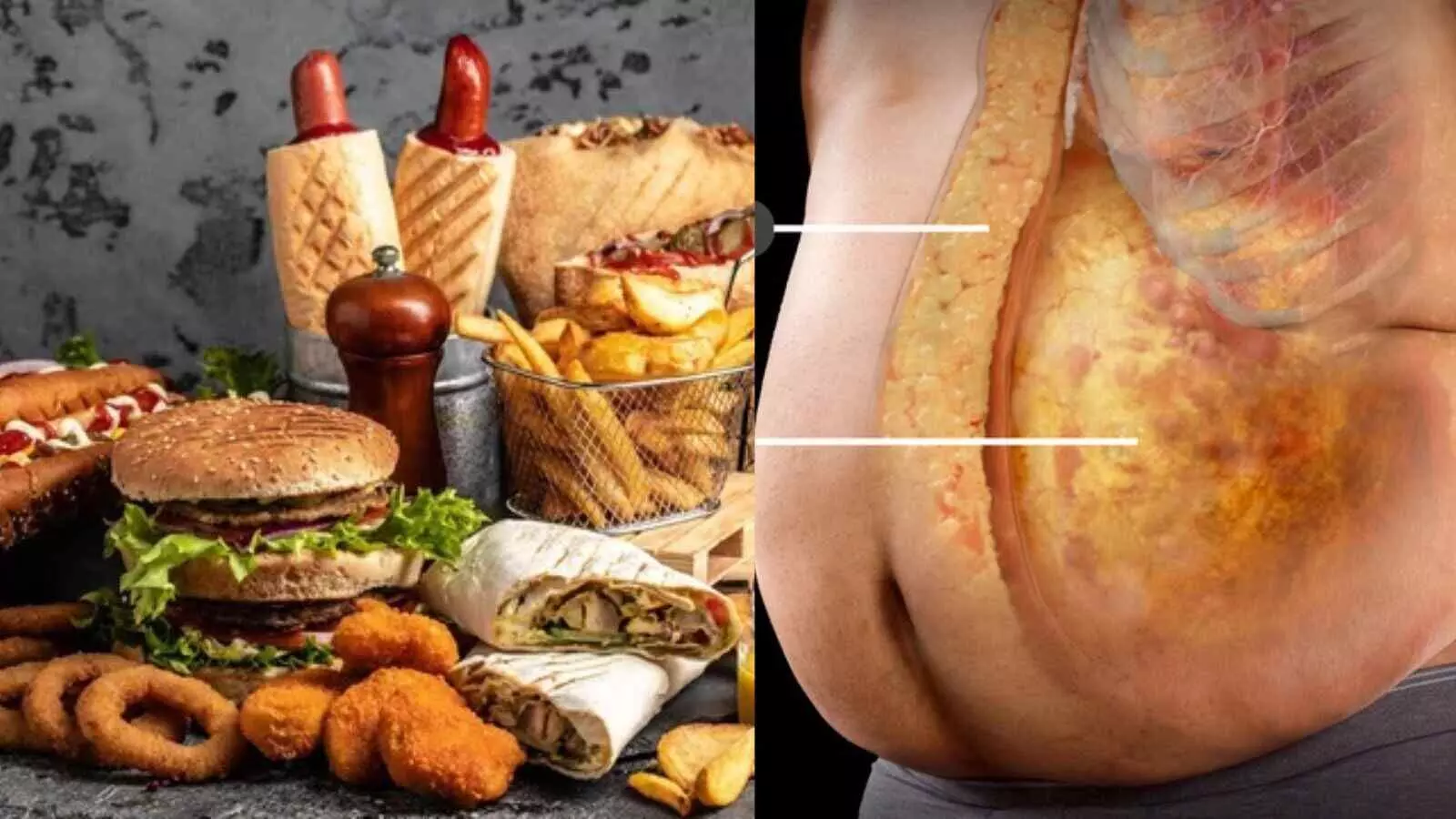 प्लेट से पेट तक चर्बी का सफर, जानें आखिर क्यों मुश्किल लगती है फिटनेस