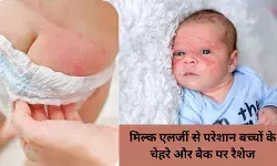 मिल्क एलर्जी से परेशान बच्चों के लिए वैज्ञानिकों का आसान समाधन