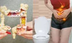 पेट ठीक से साफ क्यों नहीं होता? आंत में नहीं यहां छिपा है इसका कारण