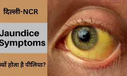 दिल्ली-NCR में मौसमी बीमारी से बड़ी समस्या है पीलिया,अनदेखी मुख्य कारण