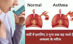 ठंड में इन कारणों से बढ़ता है अस्थमा, दिल्ली-NCR वाले रखें खास ध्यान