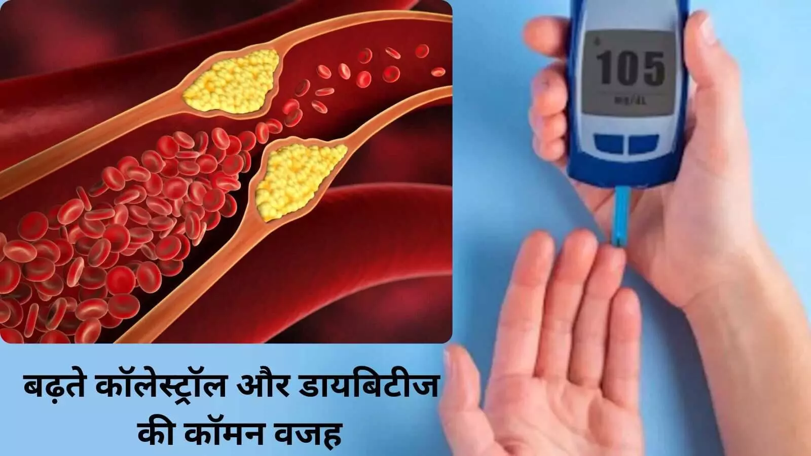 अग्नाश्य में घटा विटामिन-डी तो घेर लेगी डायबिटीज और बढ़ेगा कोलेस्ट्रॉल अग्नाश्य में घटा विटामिन-डी तो घेर लेगी डायबिटीज और बढ़ेगा कोलेस्ट्रॉल