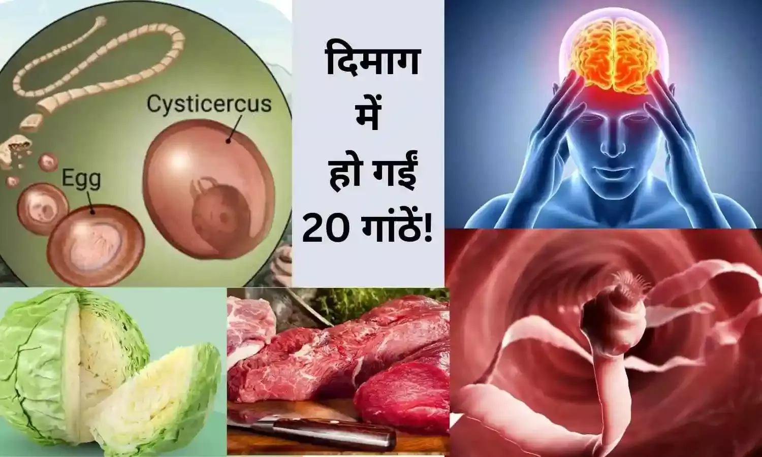 फास्ट फूड से हुईं दिमाग में 20 गांठें! बीमारी ने ली NEET छात्रा की जान