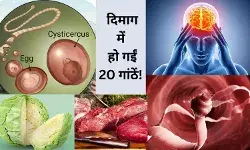 फास्ट फूड से हुईं दिमाग में 20 गांठें! बीमारी ने ली NEET छात्रा की जान