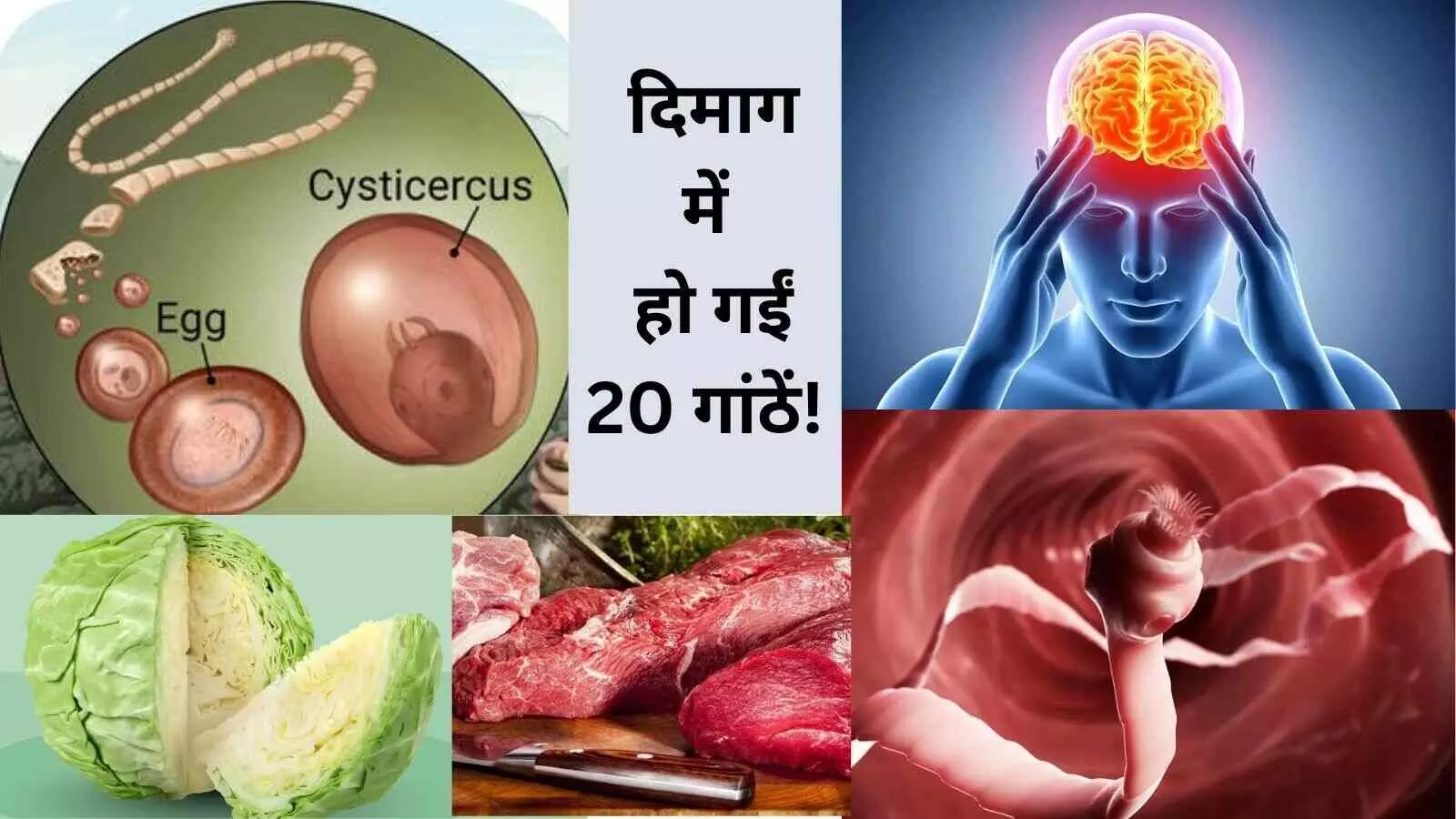 फास्ट फूड से हुईं दिमाग में 20 गांठें! बीमारी ने ली NEET छात्रा की जान फास्ट फूड से हुईं दिमाग में 20 गांठें! बीमारी ने ली NEET छात्रा की जान