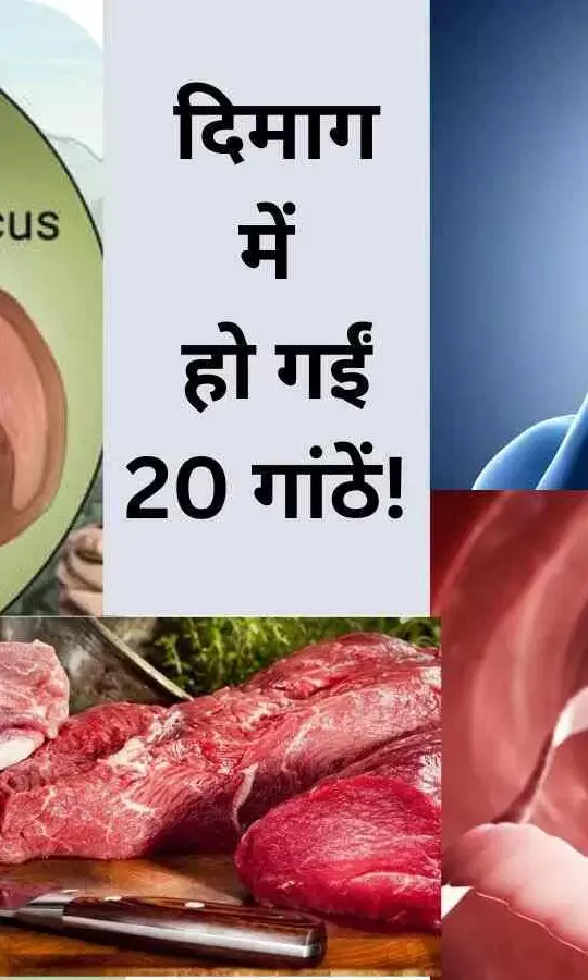 फास्ट फूड से हुईं दिमाग में 20 गांठें! बीमारी ने ली NEET छात्रा की जान