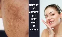 मेलाज्मा हॉर्मोन्स की समस्या है, चेहरे पर उभरे दागों को ना करें अनदेखा